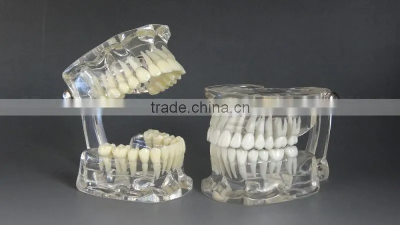 Dental standard transparent dentition model DEA-46