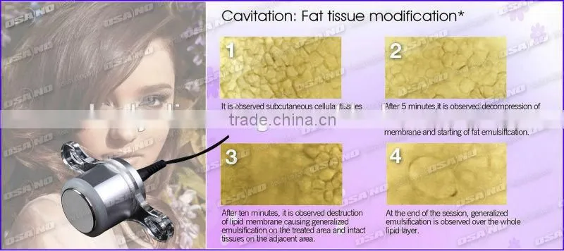2 handles vacuum slimming machine facial rf /vacuum roller fat freezing machine/cavitation machine