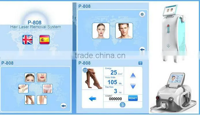 2016 professional 808nm diode laser hair removal machine/ 808 diode laser