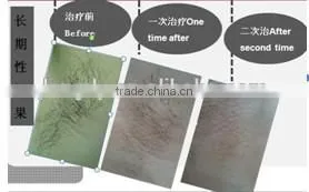 810 DIODE LASER HAIR REMOVAL
