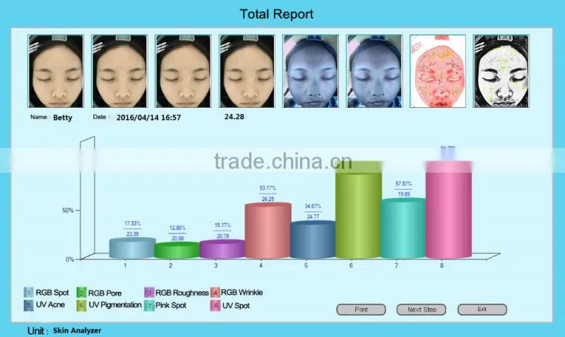 2016 popular portable magic mirror skin analyzer skin analysis machine