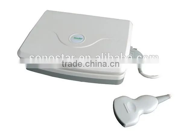 Sonostar good quality handheld portable vet ultrasound scanner pig veterinary ultrasound V10(SS-10V )