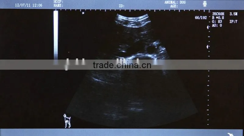 2016 high quality digital Laptop vet Ultrasound Scanner convex linear portable VET Ultrasound machine for sale