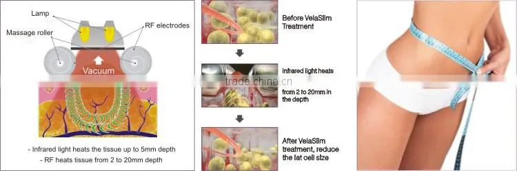 Professional cellulite massage machines/roller facial vacuum suction machine/cellulite roller massage