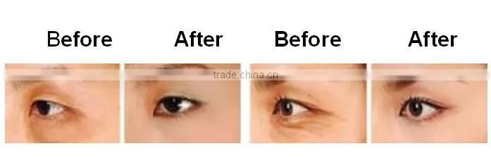 Heated infrared facial beauty roller