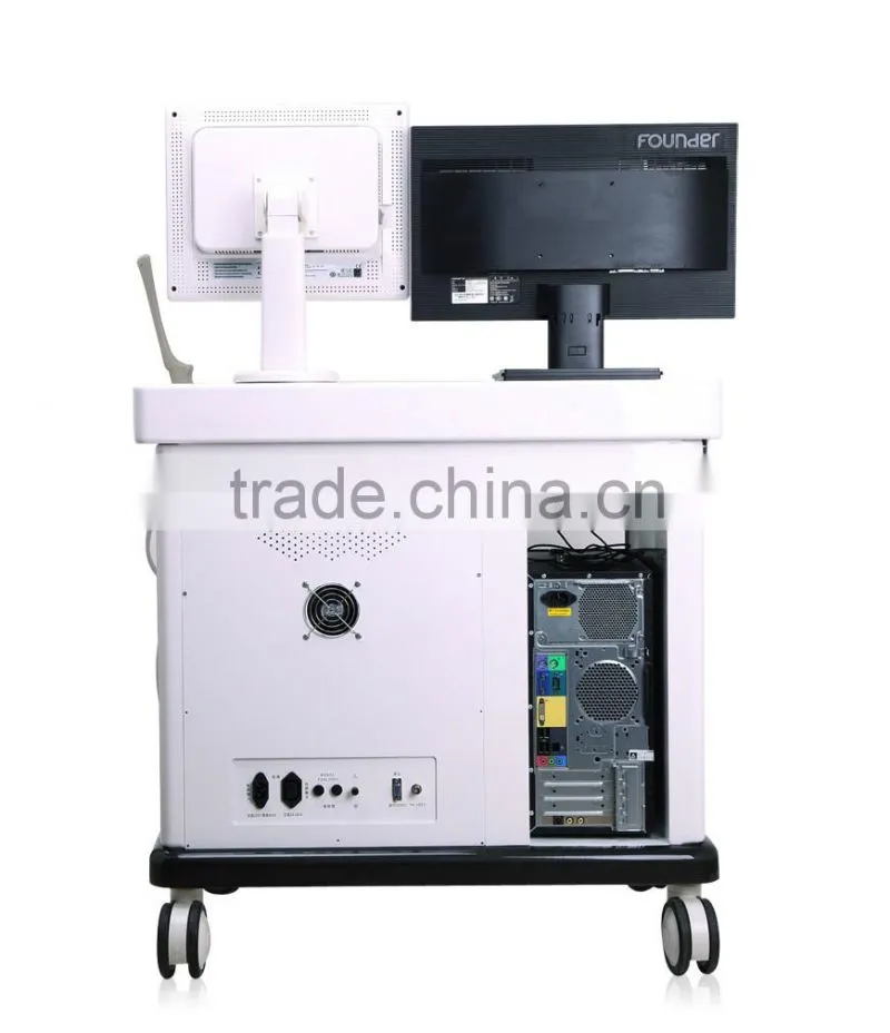 Portable Digital 15" LCD Trolley Ultrasound Scanner price with Workstation