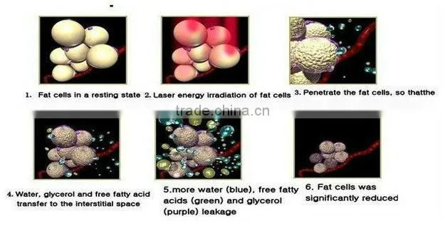 fast lipo slim!!!professional cold lipo laser slimming