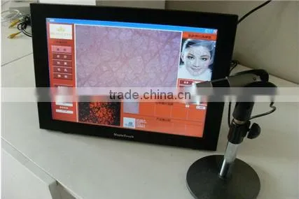 HOT SALE: smart digital CBS hair skin analyzer