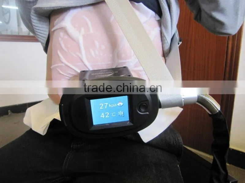 Best selling on the market!!!cryolipolysis fat freeze
