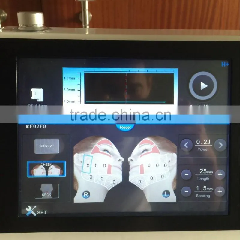 hifu/hifu machine/hifu face lift