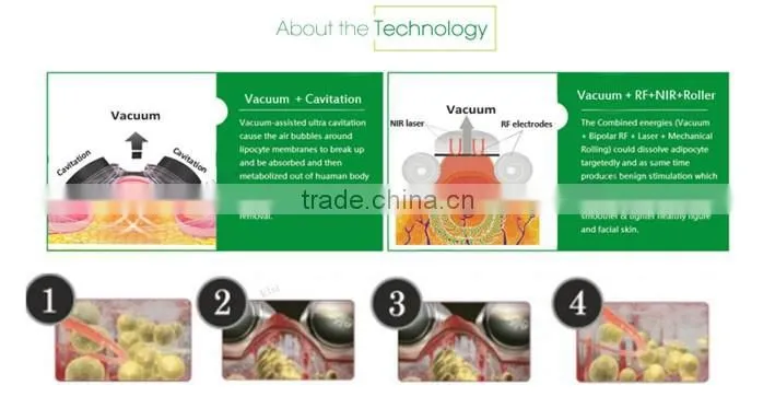 CE approved ultrasound aesthetic slimming machine