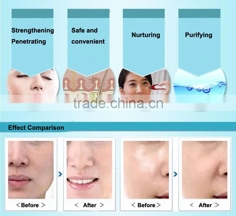 Vibration pen electric microneedle machine
