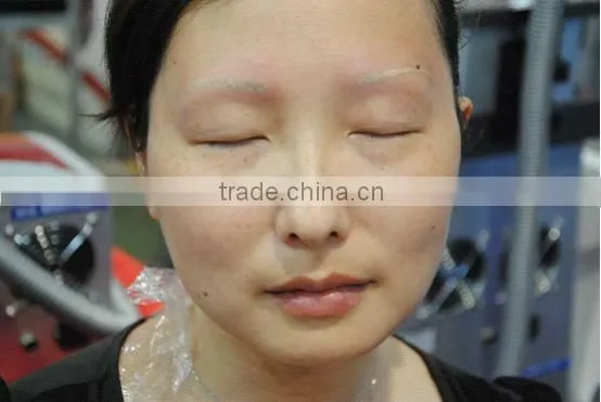 IPL RF Laser beauty equipment