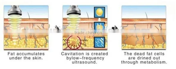 Diode laser weight loss machine NL-RUV900 Cellulite Dissolving And Body Slimming equipment
