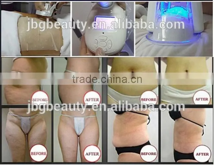Newest 5 in 1 multifunctional cavitation rf cool tech fat freezing slimming machine