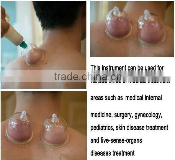 health anti cellulite vacuum silicone chinese nude massage cupping
