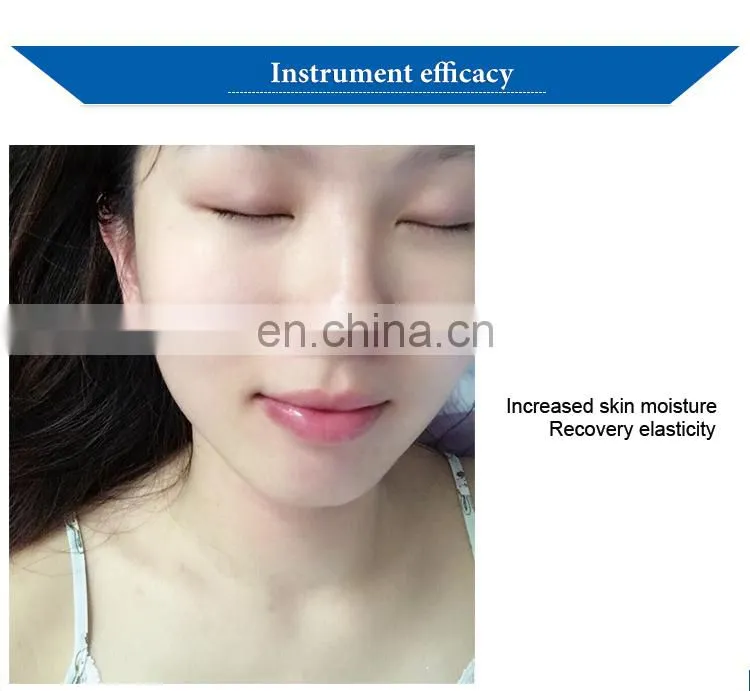 Germany Seyo TDA No Needle Mesotherapy Skin Rejuvenation Machine