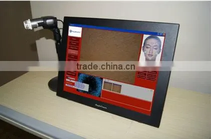 HOT SALE: smart digital CBS hair skin analyzer