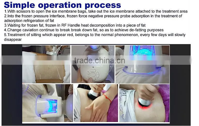 Personal care beauty equipment cold laser lipolysis slimming