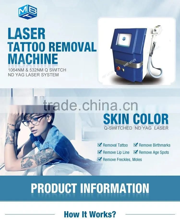 q switched nd yag laser tattoo removal 1064 nm 532nm nd yag laser laser tattoo removal