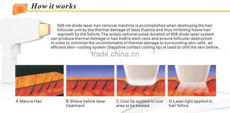 China Suppliers Painless Vertical 808 Back Hair Removal Machine