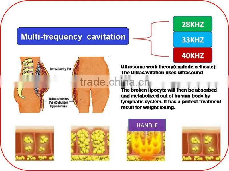 mini liposuction cavitation