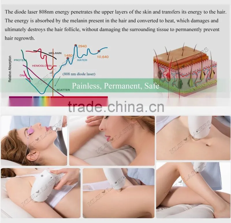 Facial / full body Diode Laser Hair Removal machine skin whitening treatment