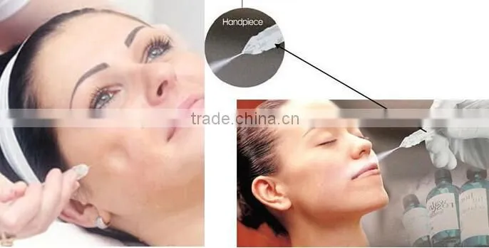 Oxygen Jet Peel Machine for skin rejuvenation
