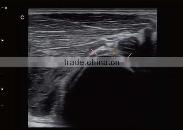 CE ISO approved medical 15 inch LCD Monitor 3D 4D trolley color doppler ultrasound scanner
