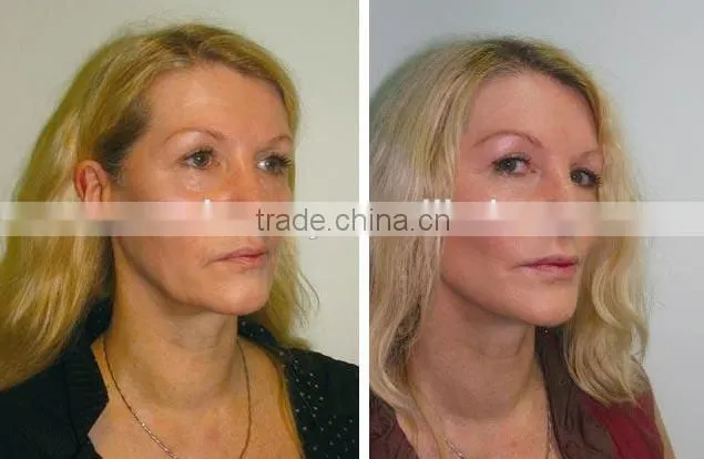 China new Multifunction Bio Oxy Skin jet water oxygene peel
