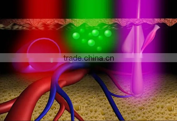 808nm medical diode 808nm laser hair removal laser spare parts