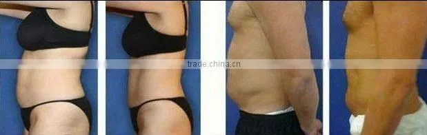 Electric infrared thermal blanket slimming