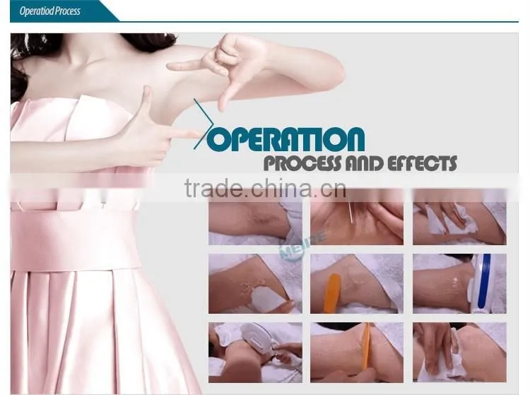 Professional e light ipl hair removal reviews