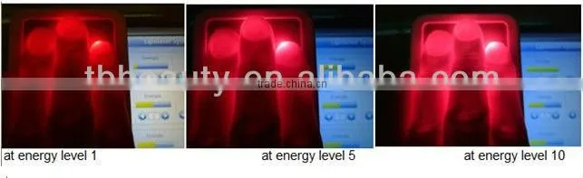 940nm Weight Loss Lipo Laser Machine with Japanese Mitsubishi Diode Laser Light