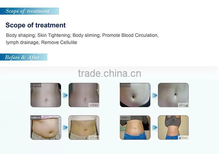 Ultrasonic cavitation rf slimming device body slimming machine for sale