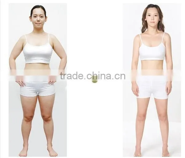 2014 bottom price 2 specialist cryolipolysis hand pieces vertical cryolipolysis cryotherapy beauty apparatus