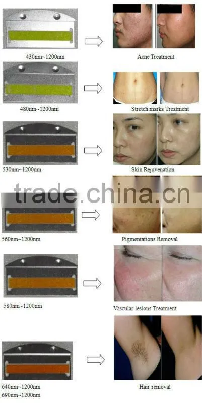 Portable IPL hair removal beauty device A003
