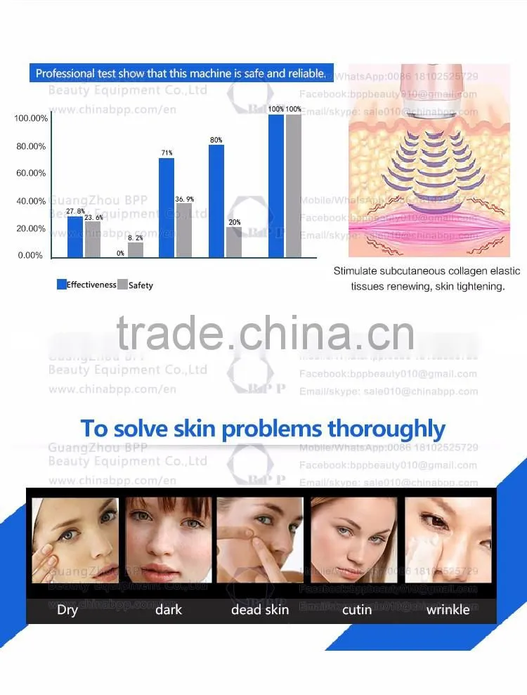 Low price diamond dermabrasion machine