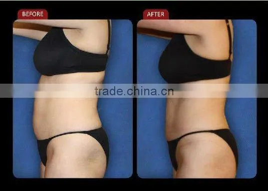 diode lipo laser / Lipo Laser Machine for Slimming