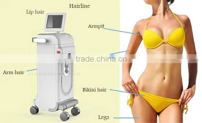 KLSi Hot Sale safe Comfortable portable diode laser hair removal machine