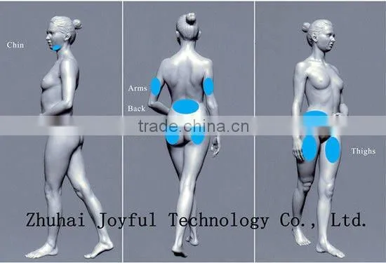 Supersonic operation system cryolipolysis fat freezing machine for body
