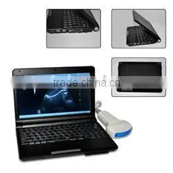 CE approved Laptop Veterinary Ultrasound Scanner with 3.5Mhz multi-frequency convex probe RUS-9000V