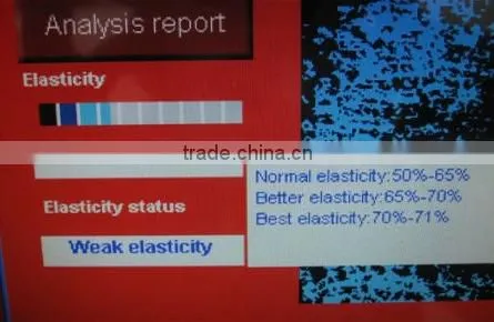 Intelligent top cbs CE FCC approved vertical skin analyzer