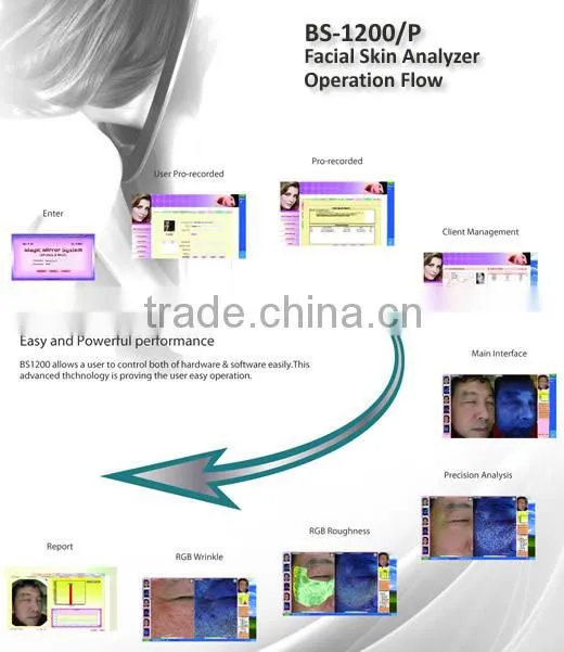 Portable UV Light Facial Skin Analysis Machine Skin Scanner
