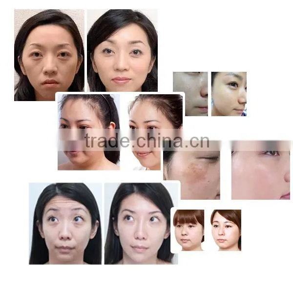 cosmetic devices meso injection gun home use removing scars and wrinkle free shipping