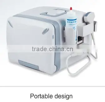 FN200V Full digital B model veterinary portable ultrasound scanner