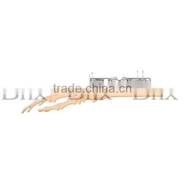 Bone Lengthening Fragment External Fixator