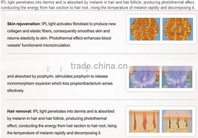 Portable IPL hair removal, skin rejuvenation equipment / shr laser ipl equipment