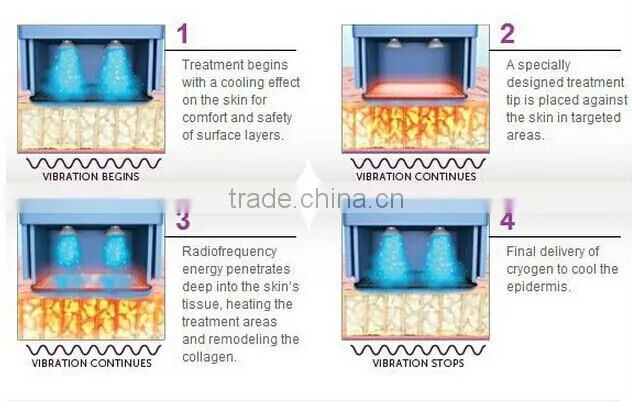 Significant effect thermagic skin tightening RF machine