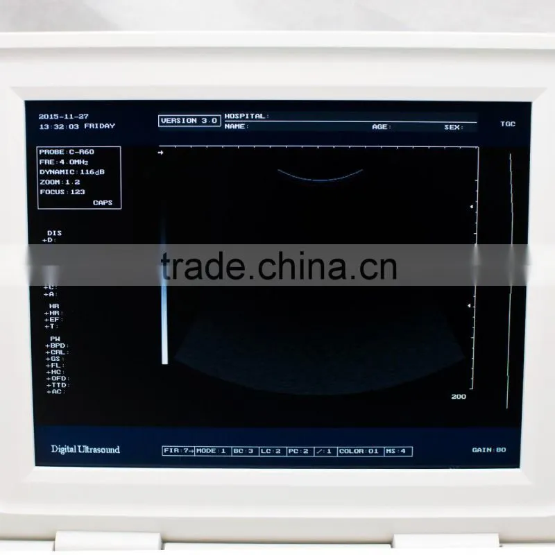 Carejoy laptop Ultrasound Machine Ultrasound Scanner with convex probe RUS-9000F2 by CE ISO approved